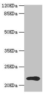 TPD52L1 Antibody in Western Blot (WB)