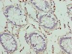 HKDC1 Polyclonal Antibody