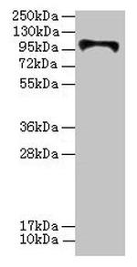 HKDC1 Antibody in Western Blot (WB)