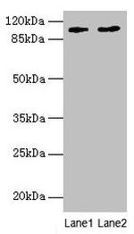CCDC57 Antibody in Western Blot (WB)
