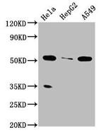 ZMYND17 Polyclonal Antibody