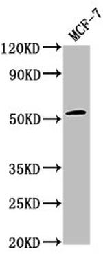 PPM1J Antibody in Western Blot (WB)