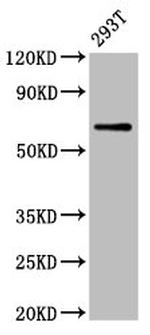 ARSH Antibody in Western Blot (WB)