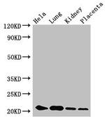 KRBOX4 Antibody in Western Blot (WB)