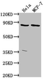 TTC39B Antibody in Western Blot (WB)