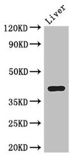 ADH7 Polyclonal Antibody