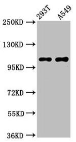 NARG2 Polyclonal Antibody