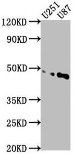 OTUD3 Antibody in Western Blot (WB)