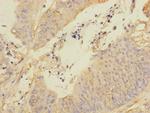 REEP5 Polyclonal Antibody