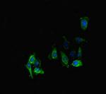 PPP2R2D Polyclonal Antibody