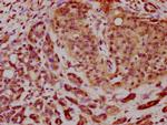 C1orf58 Antibody in Immunohistochemistry (Paraffin) (IHC (P))