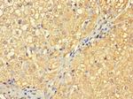 RBG1L Antibody in Immunohistochemistry (Paraffin) (IHC (P))