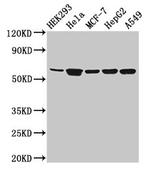 CYP4F22 Polyclonal Antibody