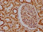 PKN3 Antibody in Immunohistochemistry (Paraffin) (IHC (P))