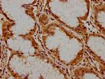PKN3 Polyclonal Antibody