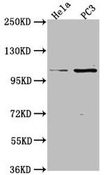 PKN3 Antibody in Western Blot (WB)