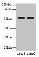 WDR88 Antibody in Western Blot (WB)