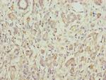 PCID1 Polyclonal Antibody