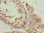 PCID1 Antibody in Immunohistochemistry (Paraffin) (IHC (P))