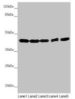PCID1 Antibody in Western Blot (WB)