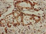 PCID1 Antibody in Immunohistochemistry (Paraffin) (IHC (P))