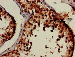 PCID1 Antibody in Immunohistochemistry (Paraffin) (IHC (P))