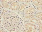 MTHFD1L Polyclonal Antibody