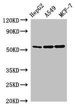 SLC24A5 Polyclonal Antibody