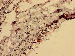 FOXR2 Antibody in Immunohistochemistry (Paraffin) (IHC (P))