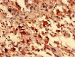 FOXR2 Antibody in Immunohistochemistry (Paraffin) (IHC (P))