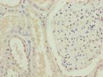FOXR2 Antibody in Immunohistochemistry (Paraffin) (IHC (P))