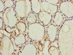 FOXR2 Polyclonal Antibody