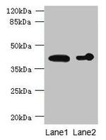 ASPHD2 Polyclonal Antibody