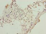 KRT80 Antibody in Immunohistochemistry (Paraffin) (IHC (P))