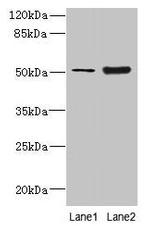 KRT80 Antibody in Western Blot (WB)
