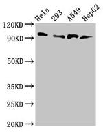 MACC1 Antibody in Western Blot (WB)
