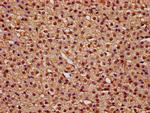 TTI2 Antibody in Immunohistochemistry (Paraffin) (IHC (P))