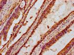 TTI2 Antibody in Immunohistochemistry (Paraffin) (IHC (P))