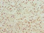PGM2L1 Antibody in Immunohistochemistry (Paraffin) (IHC (P))