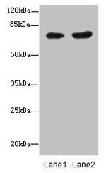 PGM2L1 Antibody in Western Blot (WB)