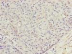 TTLL7 Polyclonal Antibody