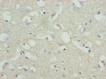 STOX1 Polyclonal Antibody