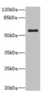 CYP4V2 Antibody in Western Blot (WB)