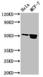 AP2 beta Polyclonal Antibody