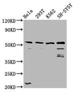 RIPX Antibody in Western Blot (WB)