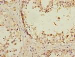 ANKS1B Polyclonal Antibody