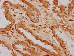 ILDR1 Polyclonal Antibody