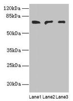 PLCZ1 Polyclonal Antibody