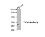 THOC6 Polyclonal Antibody