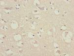 CEP57 Antibody in Immunohistochemistry (Paraffin) (IHC (P))